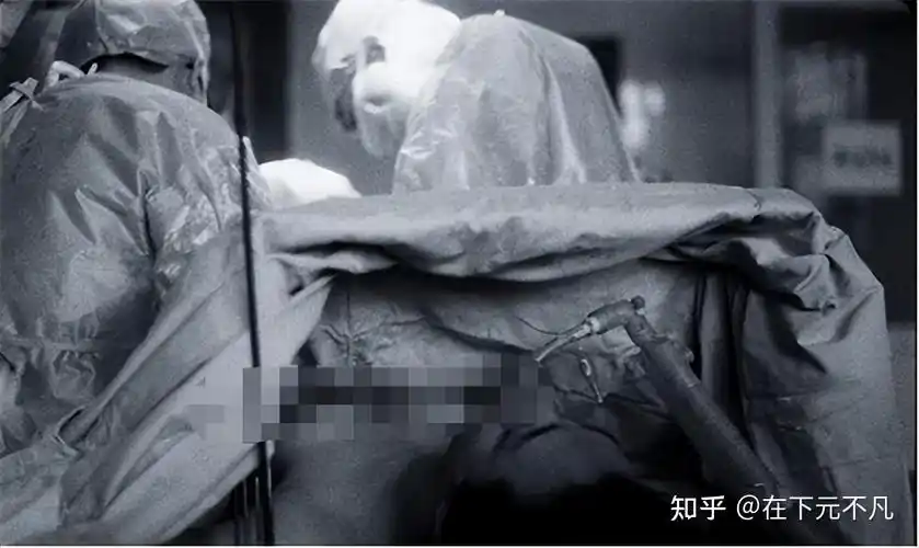 1995年4月5日,金星被推上手术台.