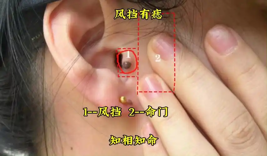 识人有术,耳朵风挡有痣