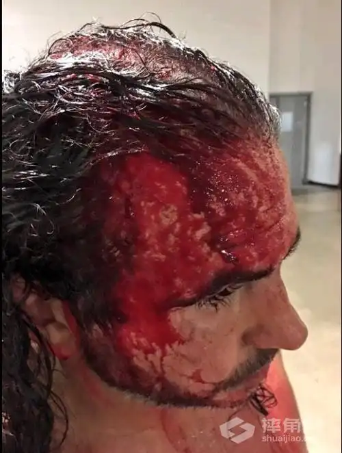 马特·哈迪被爆头,血流满面!