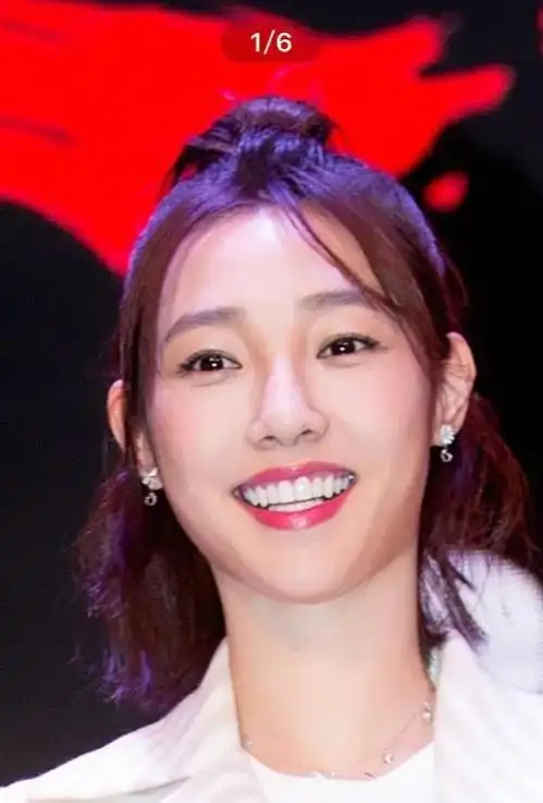 一颗瓷贴面牙齿多少钱明星假牙大pk