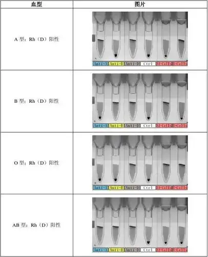 血型卡判读对照表