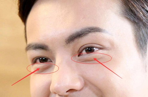 卧蚕面相图解-卧蚕看相算命-卧蚕眼是什么_易安居吉祥网