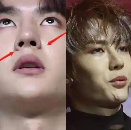 王一博又陷整容风波博主动过鼻子衰老太快旧照对比判若两人