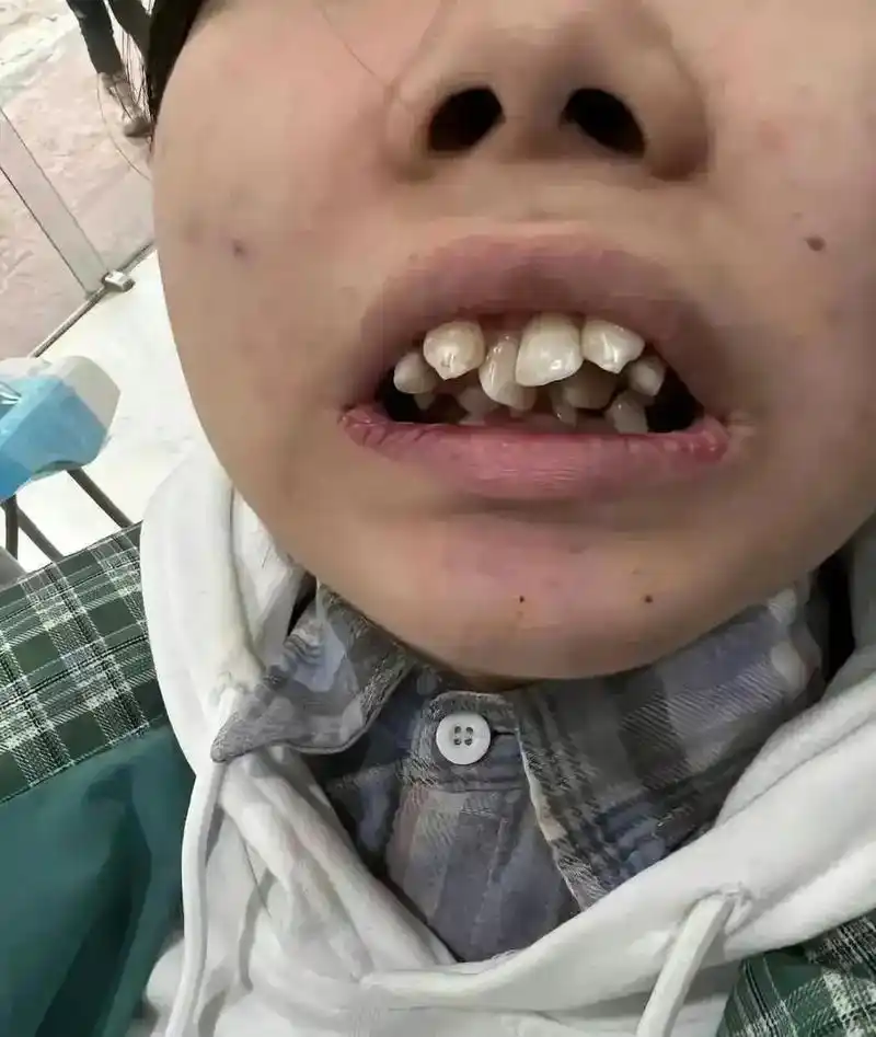 这是长了三排牙齿吗?给咬一下还得了吗?