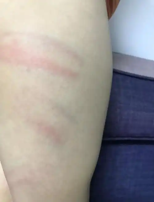 幸福广场轮滑教练棍打五岁孩子,出手狠,妈妈深夜不能入眠