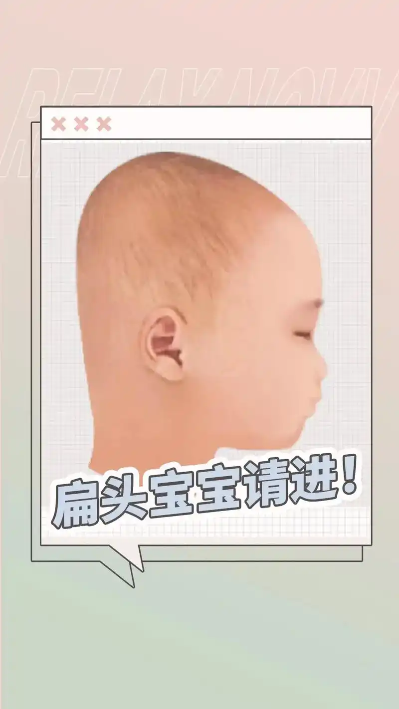 扁头宝宝这样睡,轻松变成小圆头,亲测有效.#扁头圆头 #扁头 - 抖音