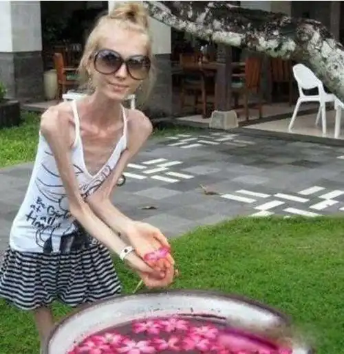 世界上最瘦的女人是谁kseniyabubenko皮包骨头的图片