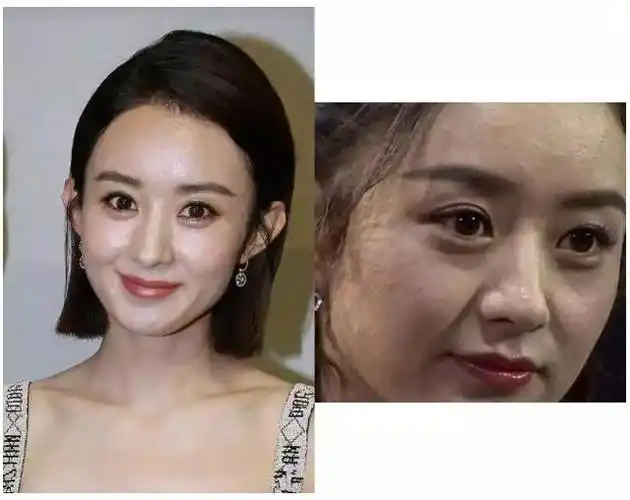 女明星也有的皮肤烦恼,黑头多的恶心