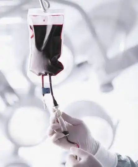 在医院输血时,如果发生溶血性输血反应怎么办? - 知乎