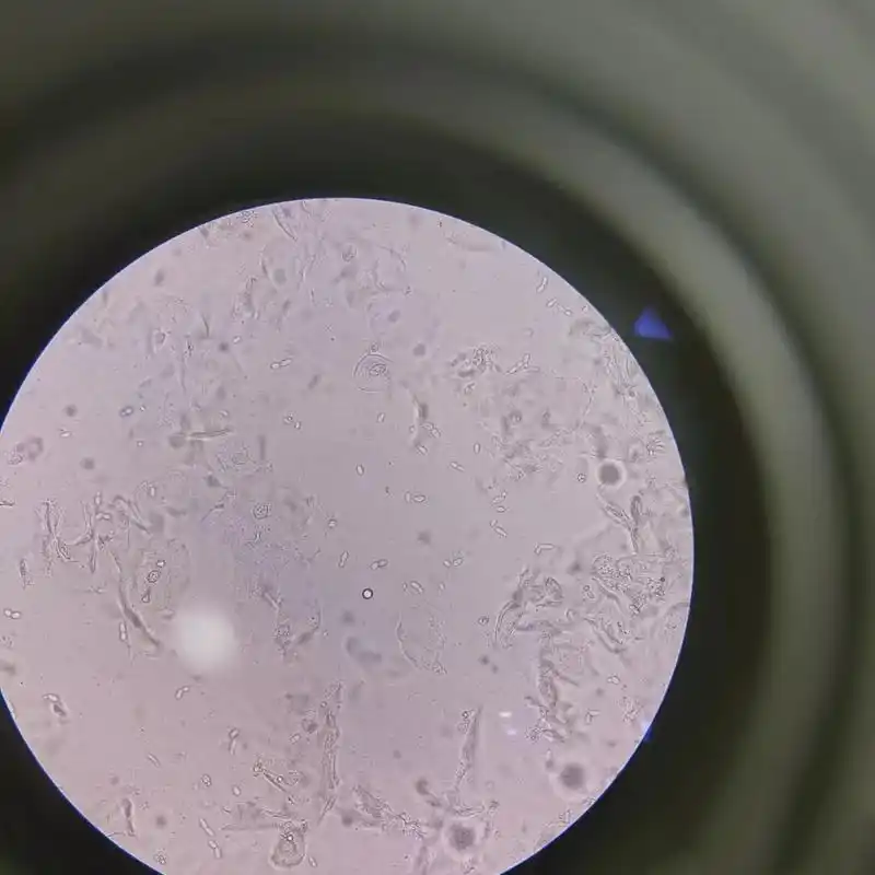 白带镜检~真菌孢子