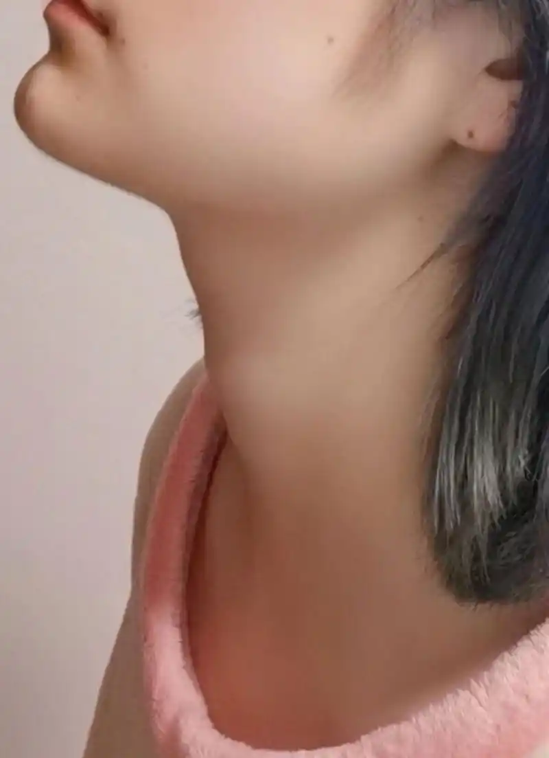 女生长喉结是不是不正常? 各位刘亦菲们!