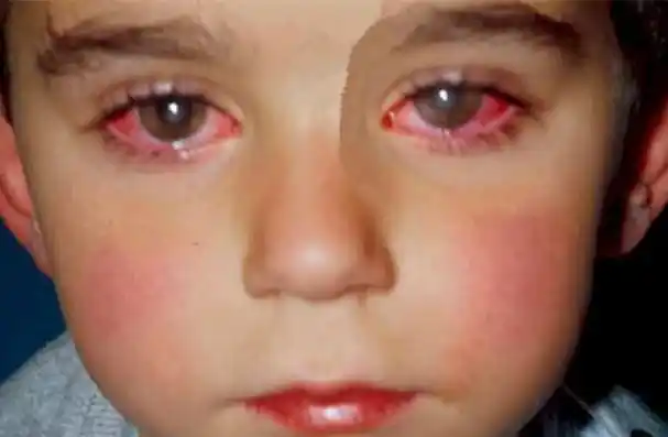 澳洲14岁少年碰了「几乎每个人家里都有的玩具」,结果意外造成眼睛