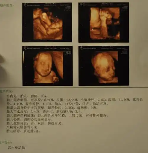 b超看胎儿男女医生是怎么向你暗示胎儿性别的