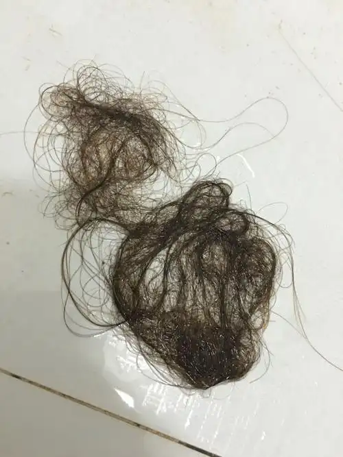 几个月一直掉,有时不怎么掉,不过还是要一直正常人的头发量少很多很多