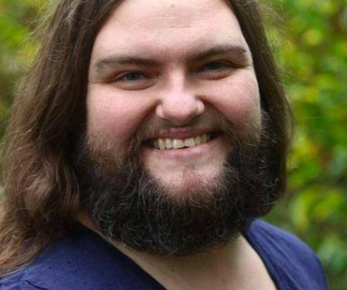 美国一女子满脸胡子体毛旺盛,医生也没办法,如今成这样!