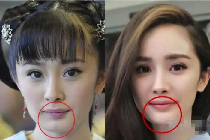 杨幂到底有没有整容呀杨幂整容史扒皮分析