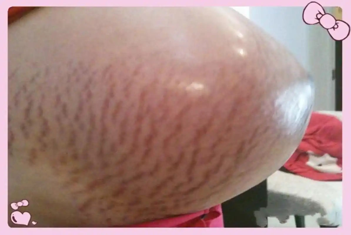 原创孕妈挺悬垂肚孕检满脸都是双胞胎幸福感医生不是好现象