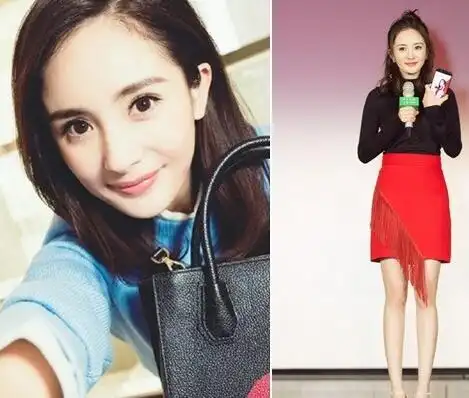 杨幂美腿布满淤青惹心疼 乐观面对:像豹纹