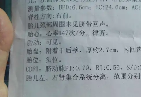 孕检时,b超单上若出现这3种"迹象",或许要迎接"小棉袄"_数据_小宝宝