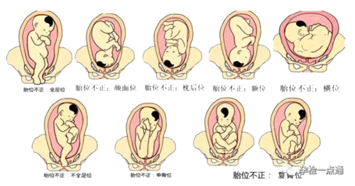 这,从出生姿势可以判断此生命运?_胎儿