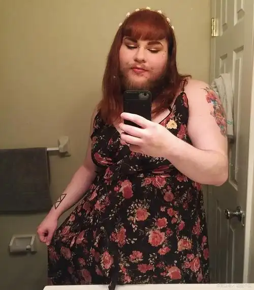 女人胡须长代表什么