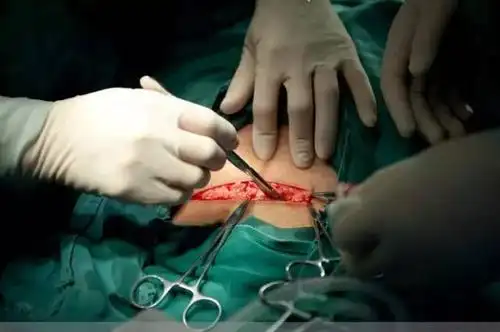 钦仰!生孩子怎么生"多多益善"-第1张图片-若克网