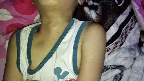 请问我小孩咽喉这里有点肿起来说话时看得见这是为什么谢谢