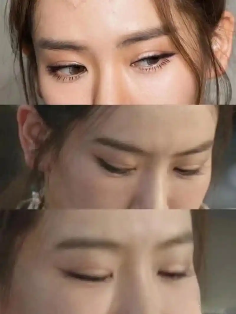 戚薇割了双眼皮后感觉眼睛没有以前好看了,明明之前眼睛的形状很灵动