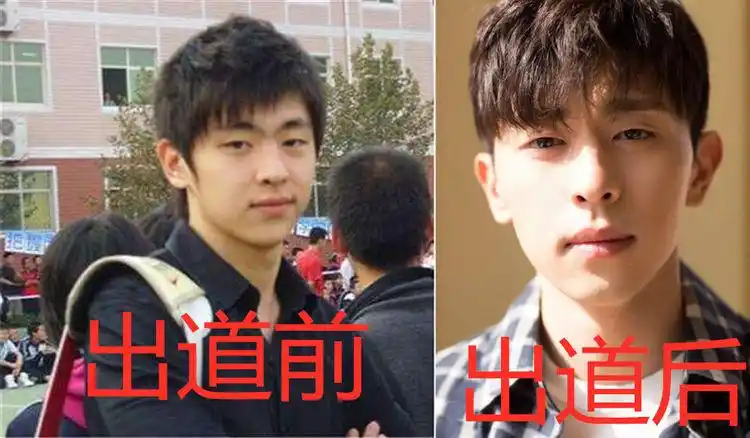 原创有一种整容叫做出道前vs出道后看到图四我需要救心丸