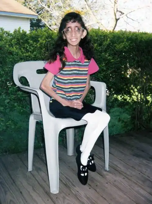 相当于一个8岁的小女孩她的体重却一直维持在26公斤左右尽管一天要吃