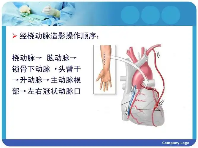 你可能喜欢 冠状动脉造影护理 冠状动脉支架植入术 冠状动脉介入 冠脉