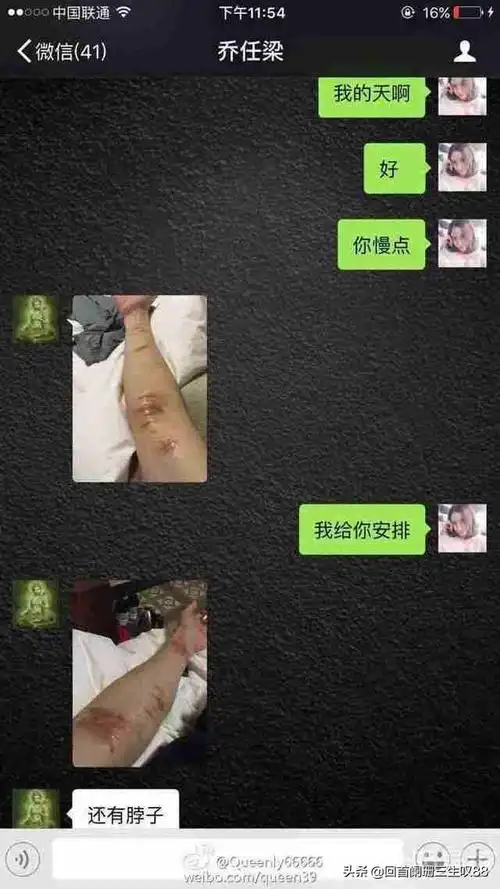 kimi遗照手臂丢失