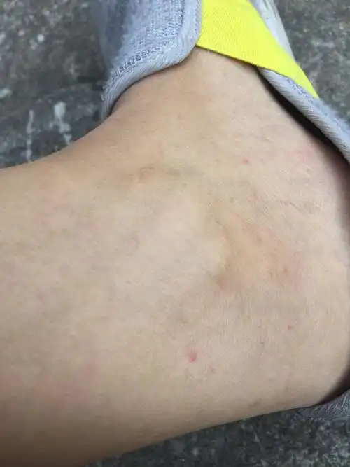 我的脚上为什么会起小红点,这些小红点也不痛不痒,为什么啊,有知道的