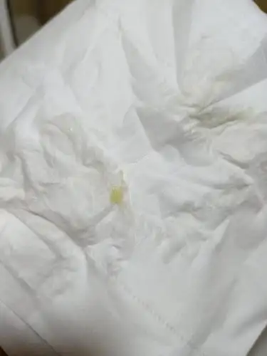 这种白带正常吗