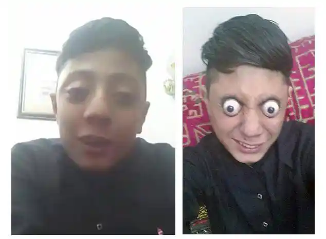 没有近视,但是眼球突出,真正的原因在这里!_手机搜狐网