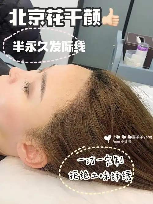 发际线高怎么办纹发际线我有话说