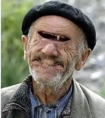 惊悚盘点世界最恐怖面目