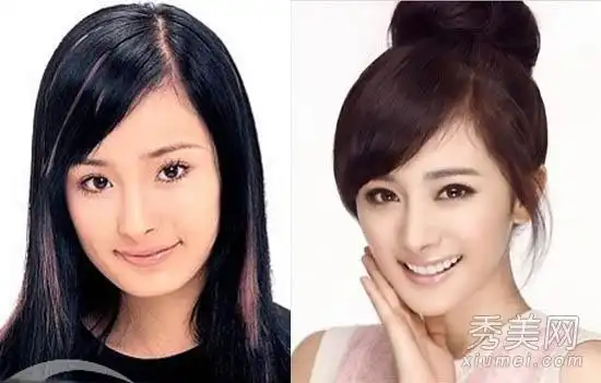 杨幂整容前后对比照