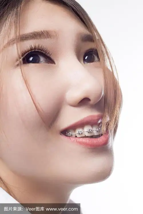 一个戴着牙套的女孩的肖像