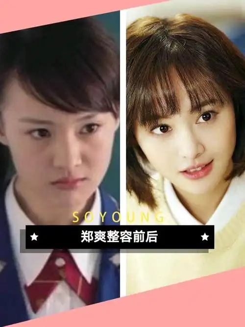 93你喜欢郑爽整容前还是整容后的脸呢?