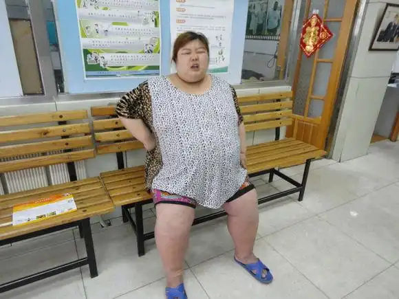 "辽宁第一胖女孩"一年要减200公斤【长春康达】