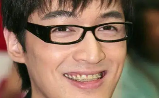 矫正牙齿宛如整容,李云迪戴牙套后判若两人,胡歌满口钢丝挺丑的|杨颖