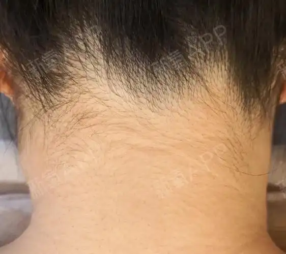 我只能说,说这个话的朋友真是太不了解发际线低的苦恼了!