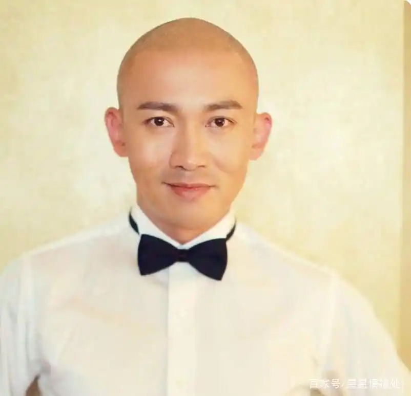 13位明星秃顶群像:沙溢陈奕迅脱发严重,王鸥杨幂发际线过高