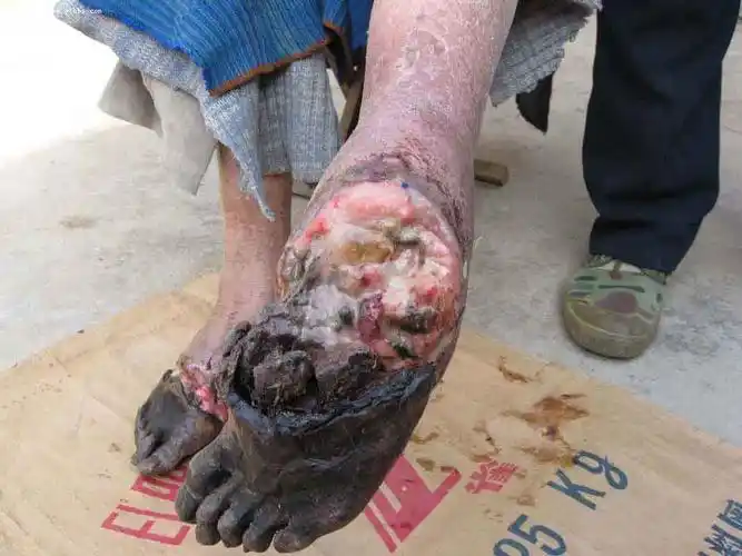 本市最惨绝人寰的惨案!谁来伸张正义!